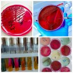 Дослідження клінічного матеріалу бактеріологічної лабораторії